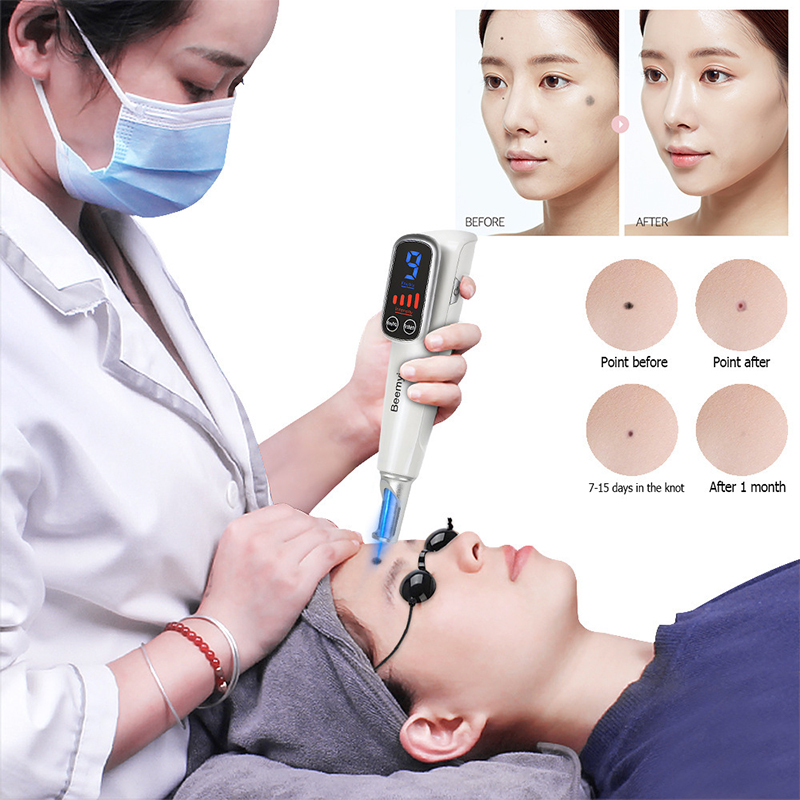 # プロフェッショナルレーザーピコセカンドペン ブルーライト - Blue Light Therapy Pen Acne Spot のレビューと価格