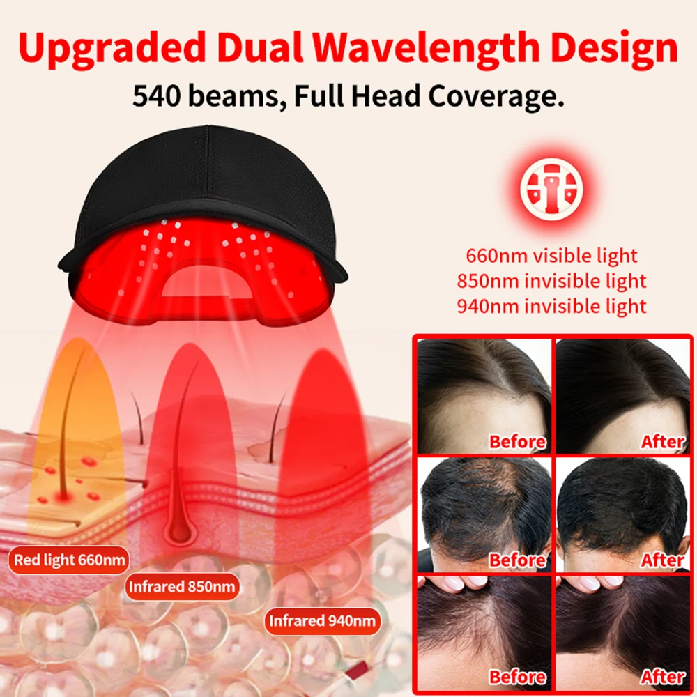 180個の赤外線LED（660nm＆850nm）搭載、育毛キ - Red Light Therapy Torch 660Nm のレビューと価格